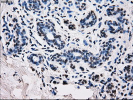 RPA2 Antibody in Immunohistochemistry (Paraffin) (IHC (P))