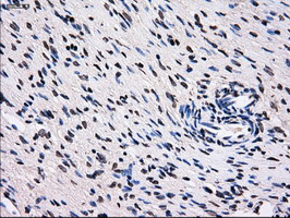 RPA2 Antibody in Immunohistochemistry (Paraffin) (IHC (P))