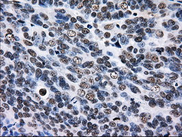 RPA2 Antibody in Immunohistochemistry (Paraffin) (IHC (P))