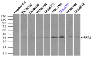 RPA2 Antibody in Immunoprecipitation (IP)