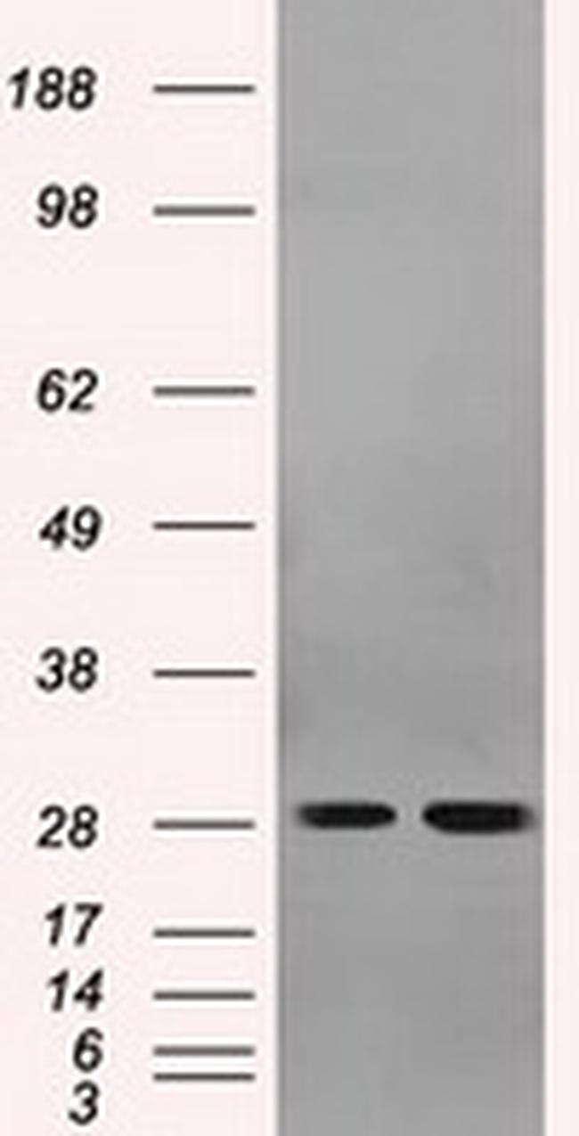 RPA2 Antibody in Western Blot (WB)