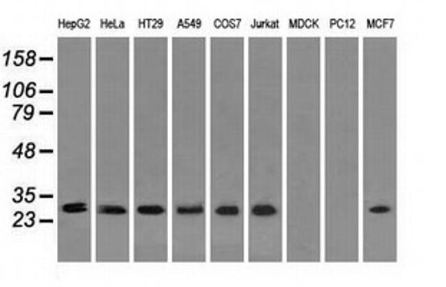 RPA2 Antibody in Western Blot (WB)