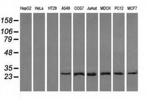 RPA2 Antibody in Western Blot (WB)