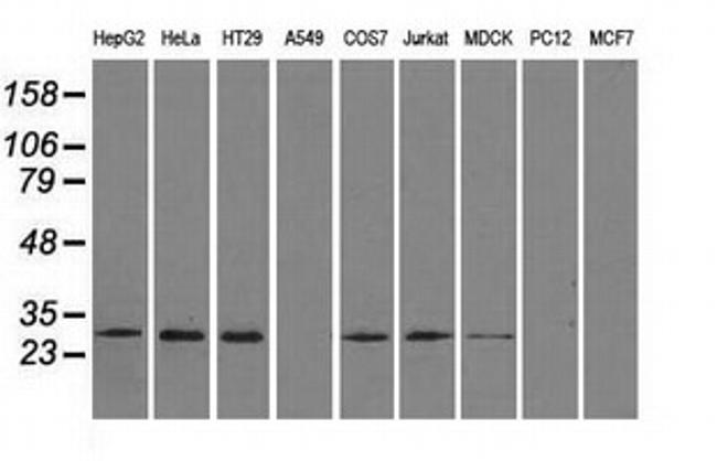 RPA2 Antibody in Western Blot (WB)