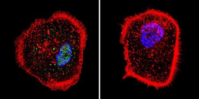 RPA2 Antibody in Immunocytochemistry (ICC/IF)