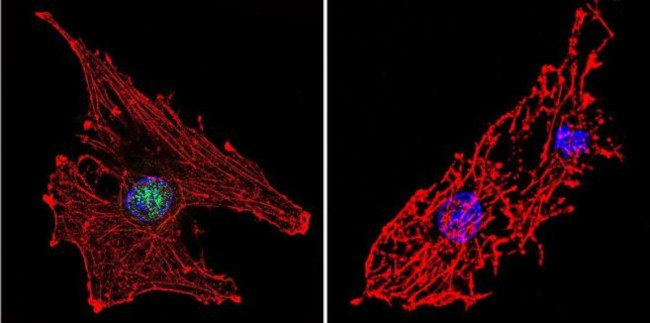 RPA2 Antibody in Immunocytochemistry (ICC/IF)