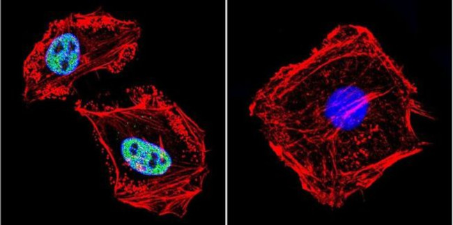 RPA2 Antibody in Immunocytochemistry (ICC/IF)