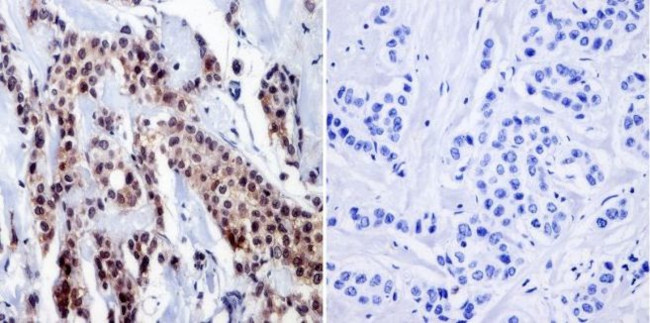 RPA2 Antibody in Immunohistochemistry (Paraffin) (IHC (P))