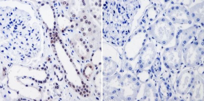 RPA2 Antibody in Immunohistochemistry (Paraffin) (IHC (P))