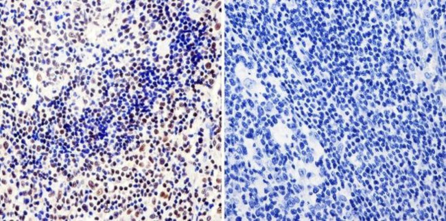 RPA2 Antibody in Immunohistochemistry (Paraffin) (IHC (P))