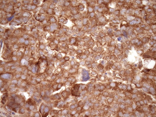 RPL10 Antibody in Immunohistochemistry (Paraffin) (IHC (P))