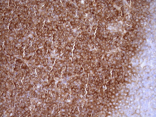 RPL10 Antibody in Immunohistochemistry (Paraffin) (IHC (P))