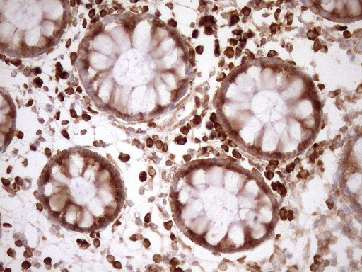 RPL10 Antibody in Immunohistochemistry (Paraffin) (IHC (P))