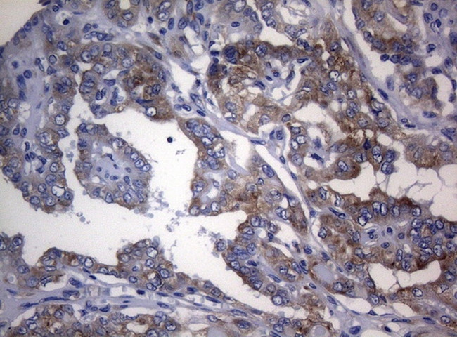 RPL10 Antibody in Immunohistochemistry (Paraffin) (IHC (P))