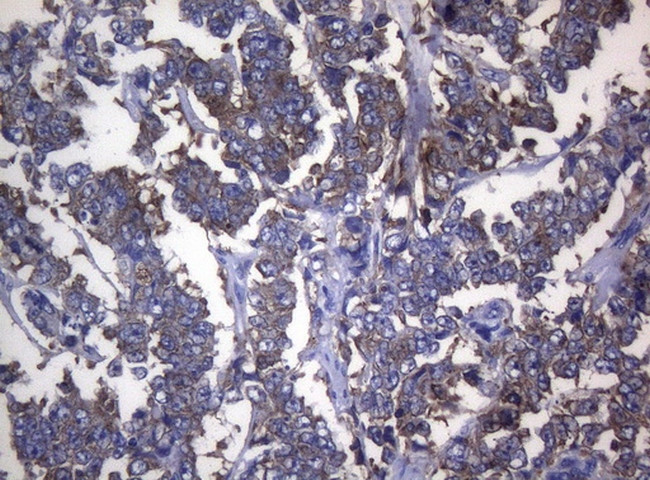 RPL10 Antibody in Immunohistochemistry (Paraffin) (IHC (P))