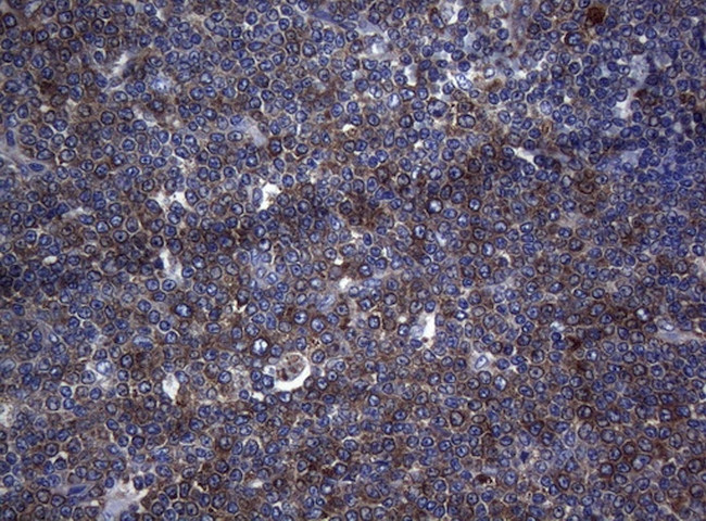 RPL10 Antibody in Immunohistochemistry (Paraffin) (IHC (P))