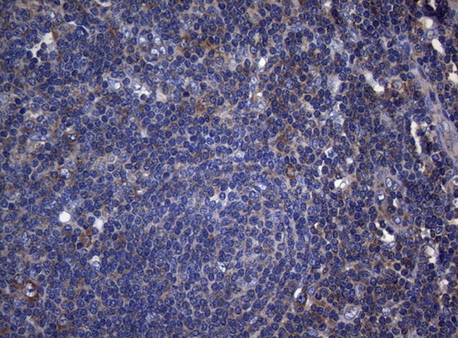 RPL10 Antibody in Immunohistochemistry (Paraffin) (IHC (P))