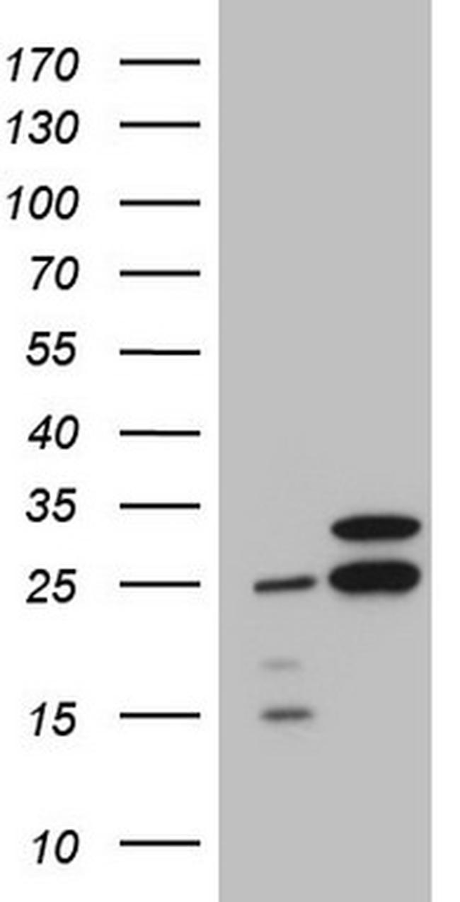 RPL10 Antibody in Western Blot (WB)