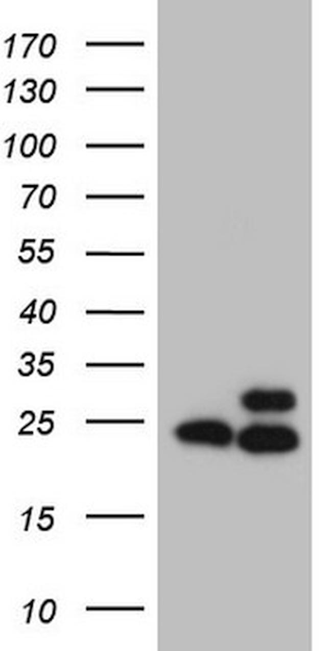 RPL10 Antibody in Western Blot (WB)