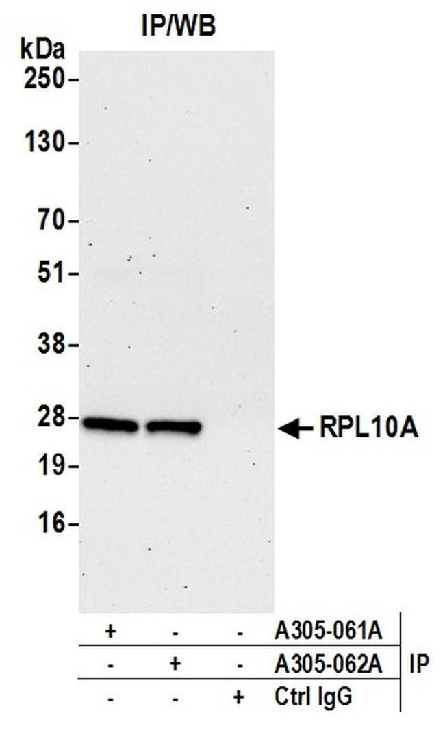 RPL10A/Ribosomal Protein L10a Antibody in Western Blot (WB)