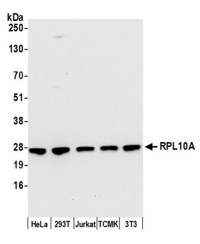 RPL10A/Ribosomal Protein L10a Antibody in Western Blot (WB)