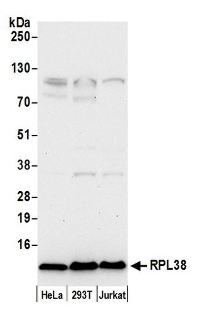 RPL38/Ribosomal Protein L38 Antibody in Western Blot (WB)