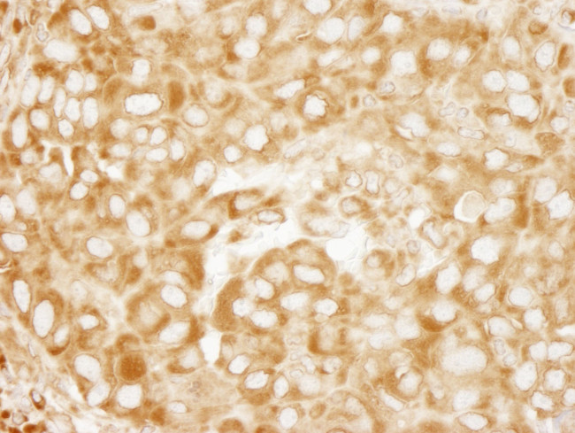 RPL7 Antibody in Immunohistochemistry (IHC)