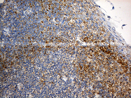 RPL7A Antibody in Immunohistochemistry (Paraffin) (IHC (P))