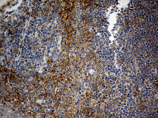 RPL7A Antibody in Immunohistochemistry (Paraffin) (IHC (P))