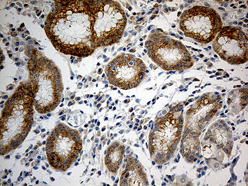 RPL7A Antibody in Immunohistochemistry (Paraffin) (IHC (P))