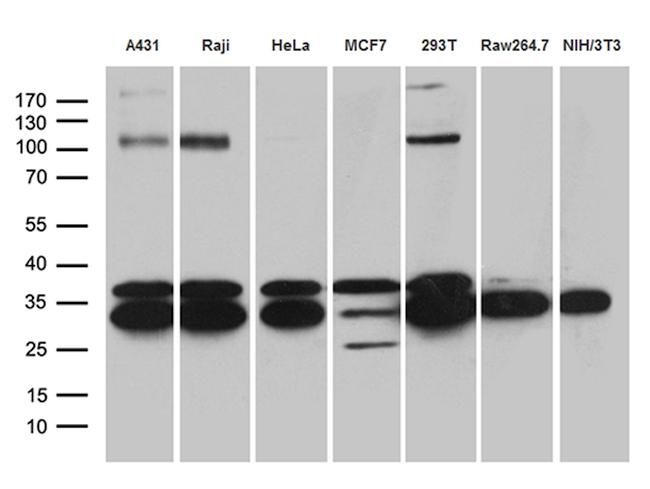 RPL7A Antibody in Western Blot (WB)