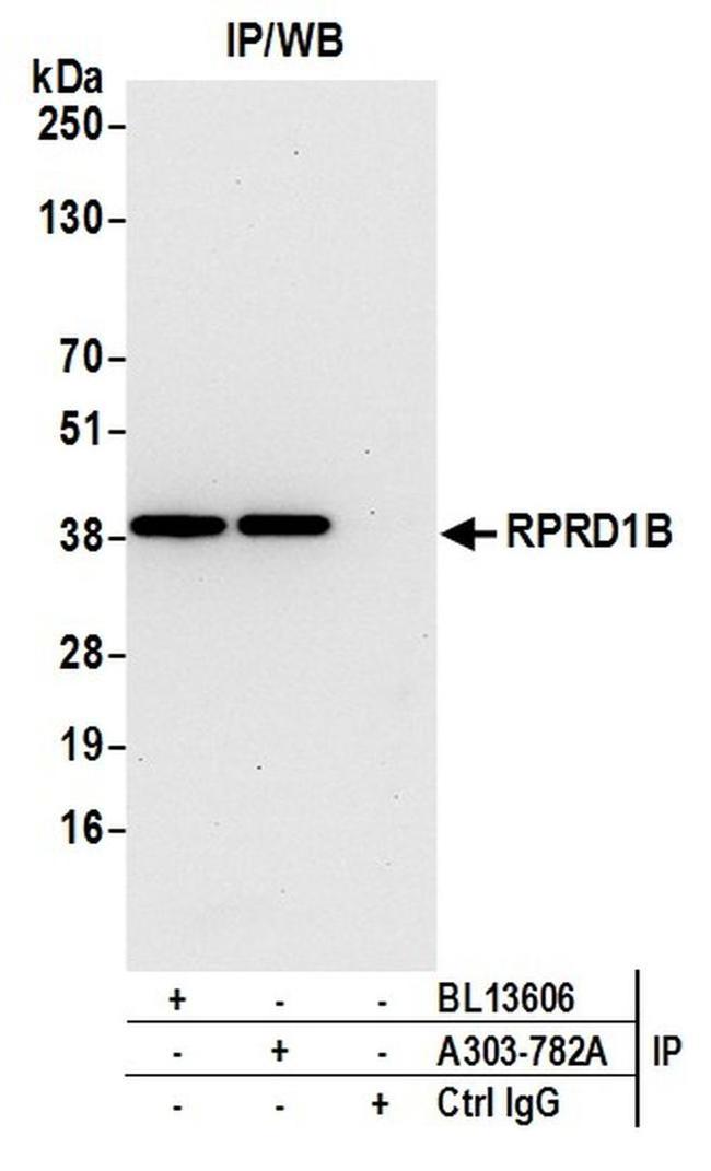 RPRD1B Antibody in Western Blot (WB)