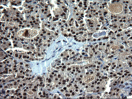 RPRD1B Antibody in Immunohistochemistry (Paraffin) (IHC (P))