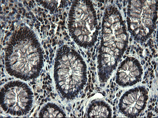 RPRD1B Antibody in Immunohistochemistry (Paraffin) (IHC (P))