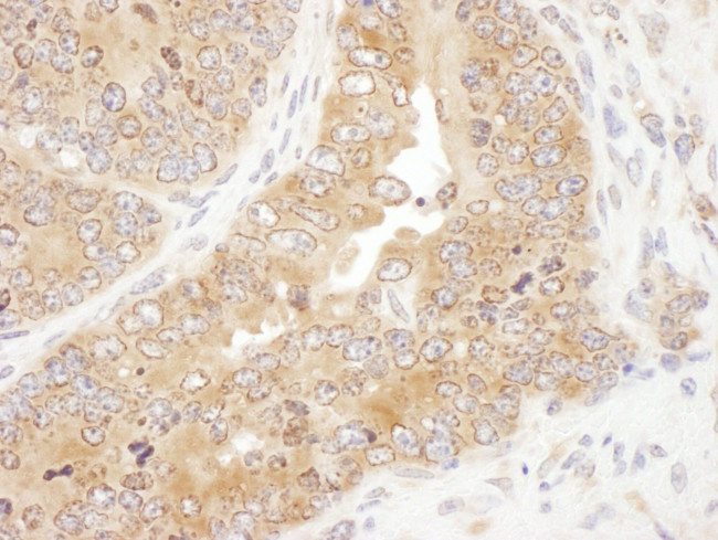 RPS5 Antibody in Immunohistochemistry (Paraffin) (IHC (P))