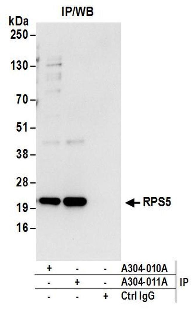 RPS5 Antibody in Western Blot (WB)