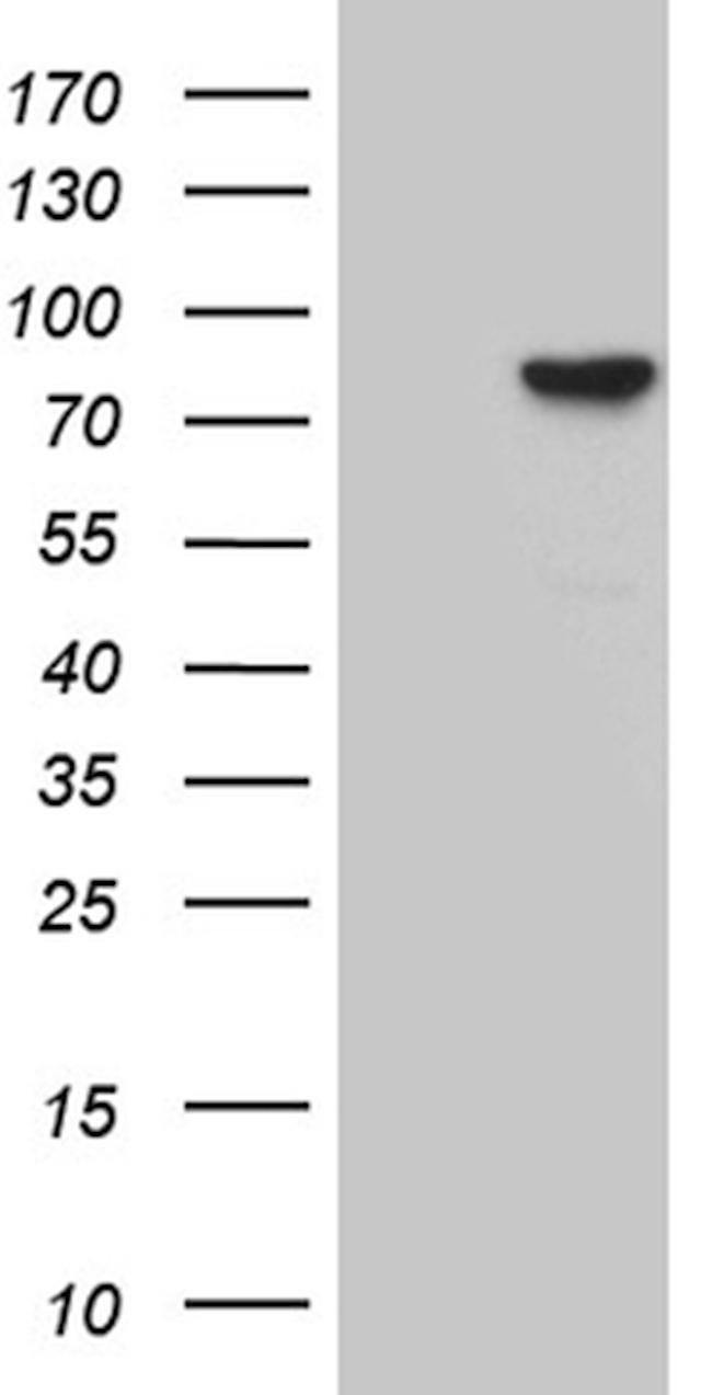 RPS6KA2 Antibody in Western Blot (WB)