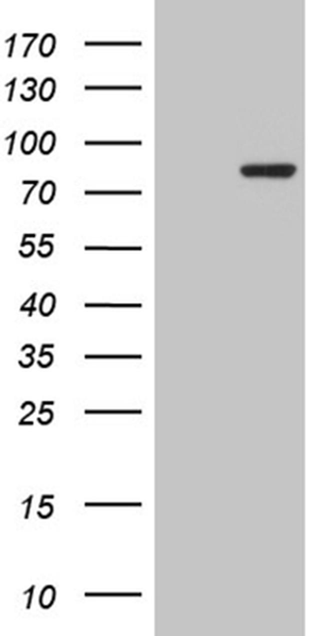 RPS6KA2 Antibody in Western Blot (WB)