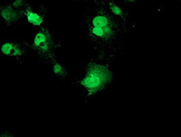 RPS6KB1 Antibody in Immunocytochemistry (ICC/IF)