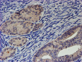 RPS6KB1 Antibody in Immunohistochemistry (Paraffin) (IHC (P))