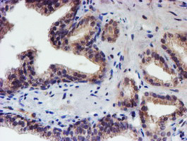 RPS6KB1 Antibody in Immunohistochemistry (Paraffin) (IHC (P))