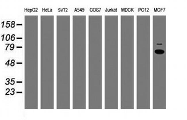 RPS6KB1 Antibody in Western Blot (WB)