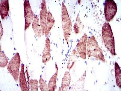 p70 S6 Kinase Antibody in Immunohistochemistry (Paraffin) (IHC (P))