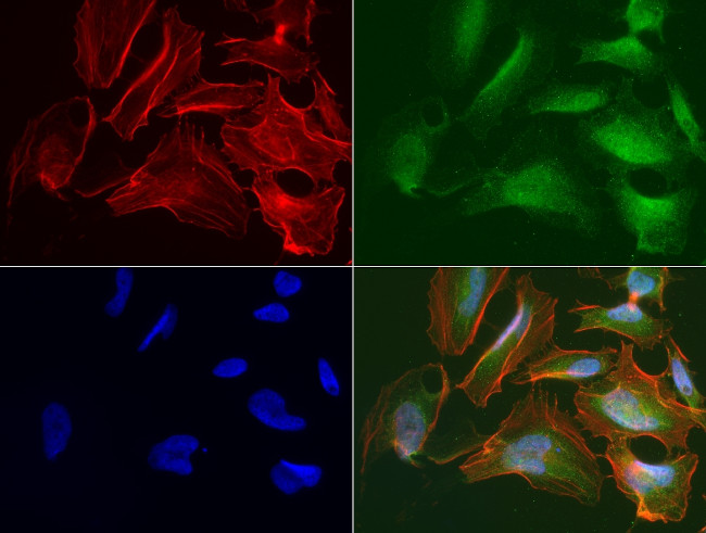 RRM1 Antibody in Immunocytochemistry (ICC/IF)