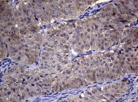 RRM1 Antibody in Immunohistochemistry (Paraffin) (IHC (P))