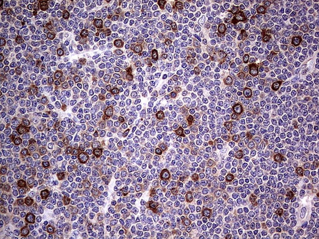 RRM1 Antibody in Immunohistochemistry (Paraffin) (IHC (P))