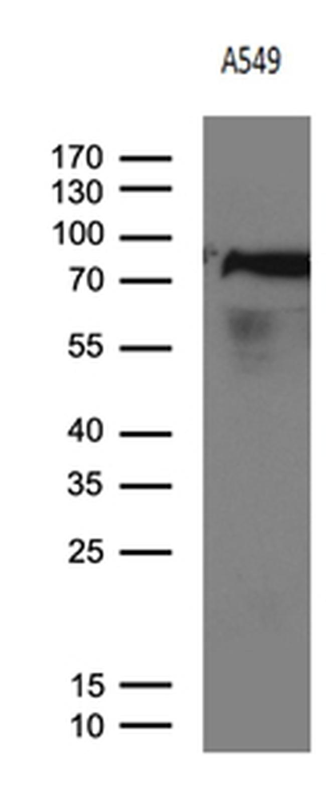 RRM1 Antibody in Western Blot (WB)