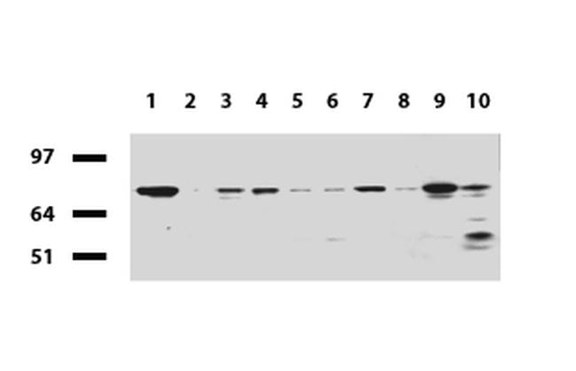 RRM1 Antibody in Western Blot (WB)