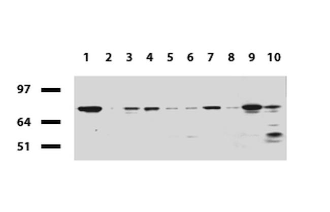 RRM1 Antibody in Western Blot (WB)