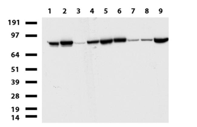 RRM1 Antibody in Western Blot (WB)